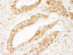 Ribosomal Protein S6/RPS6 Antibody, Novus Biologicals 0.1mL; Unlabeled:Antibodies,